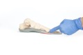 FootWave Hallux dynamiczne wkładki ortopedyczne  wskazanie