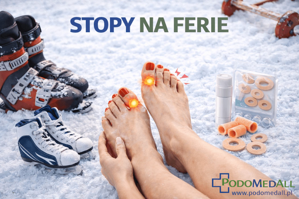 Ferie zimowe dla stóp – pielęgnacja przed i po nartach | PodoMedall